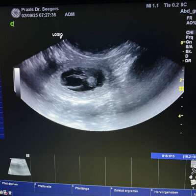 Ultraschallbild des kommenden Wurfes.