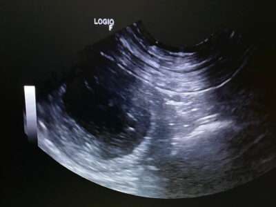 Bertas Ultraschall